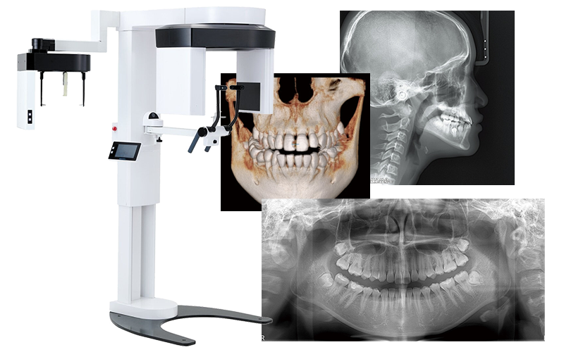 歯科用CT・デジタルレントゲン