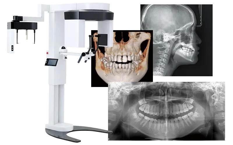 歯科用CT・デジタルレントゲン
