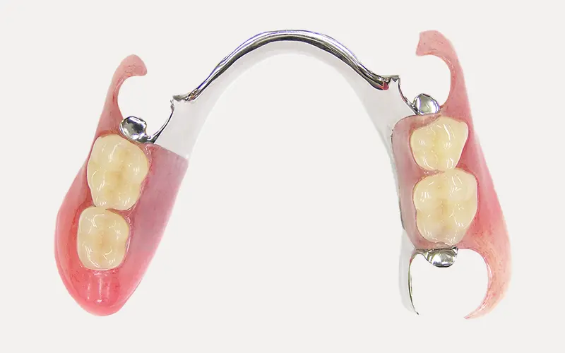 ノンクラスプ義歯