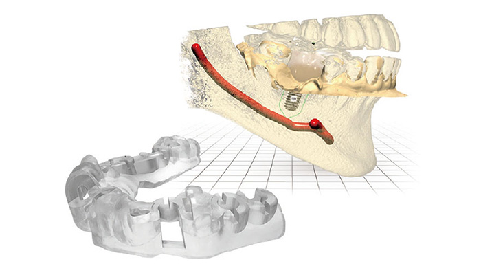 正確で安全な手術をサポート